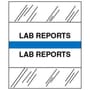 Lab Reports Chart Divider Tabs, 1-1/4" x 1/2", Light Blue (Pack of 100)